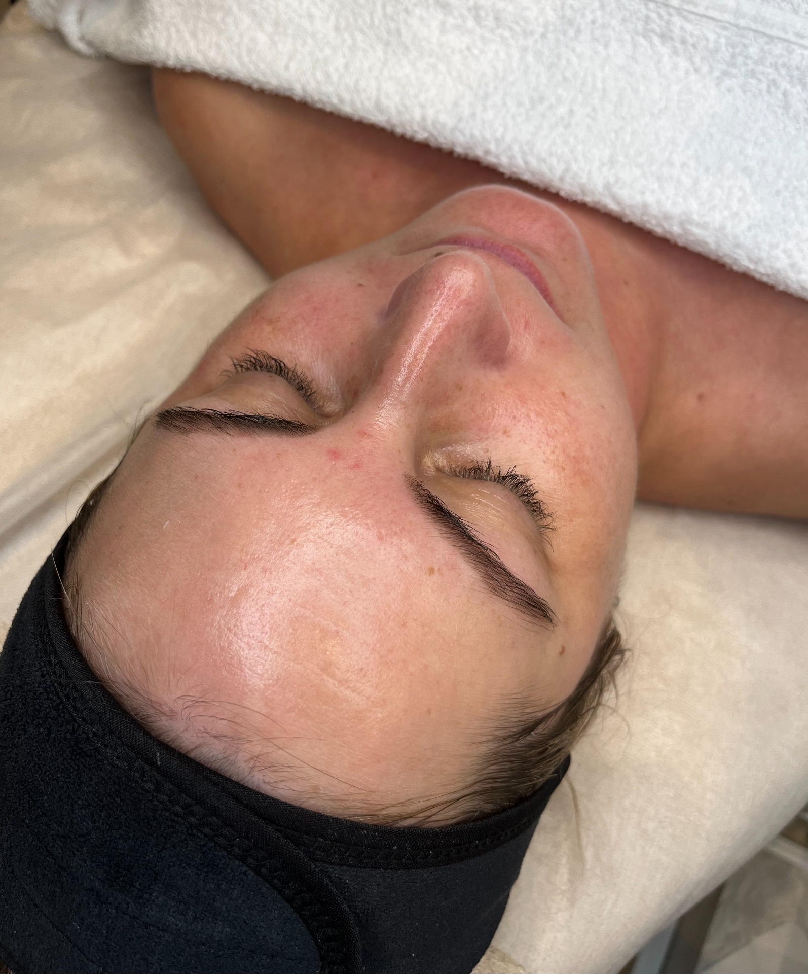 Kosmetické ošetření pleti - individuální péče